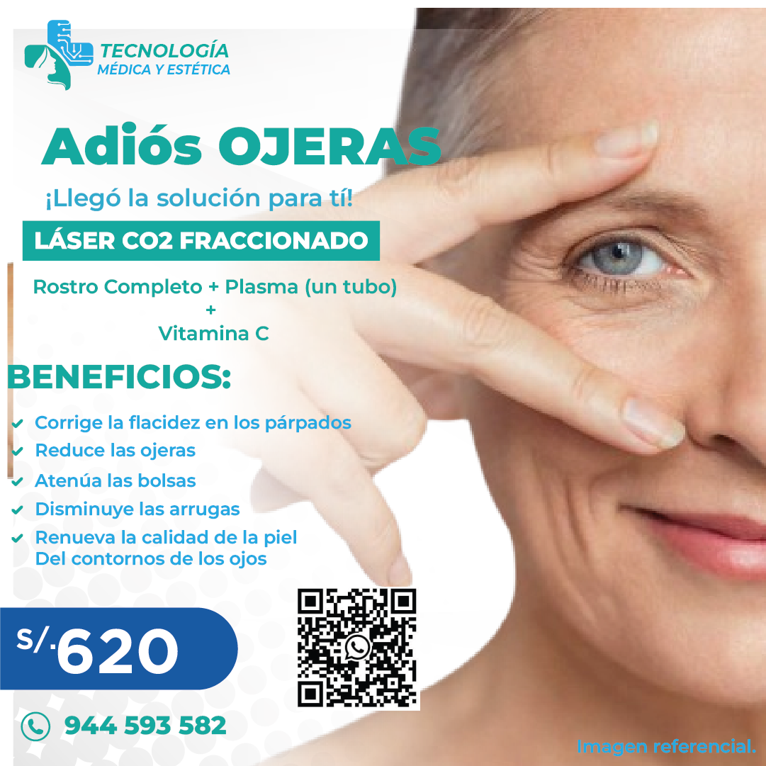 Promoción Láser CO2 - 50% OFF